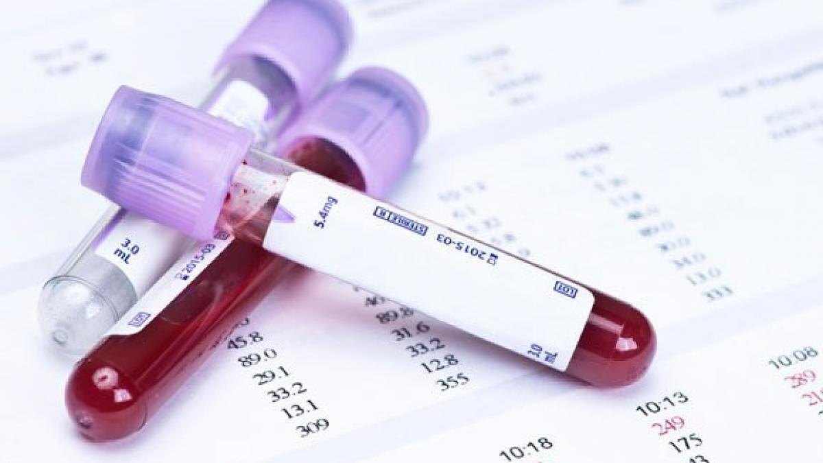 Aplicabilidade e importância do hemograma nas urgências e emergências -  Laboratório Vida - Goiânia